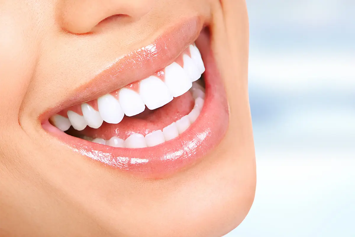 Healthy smile, illustrative dental-care visual